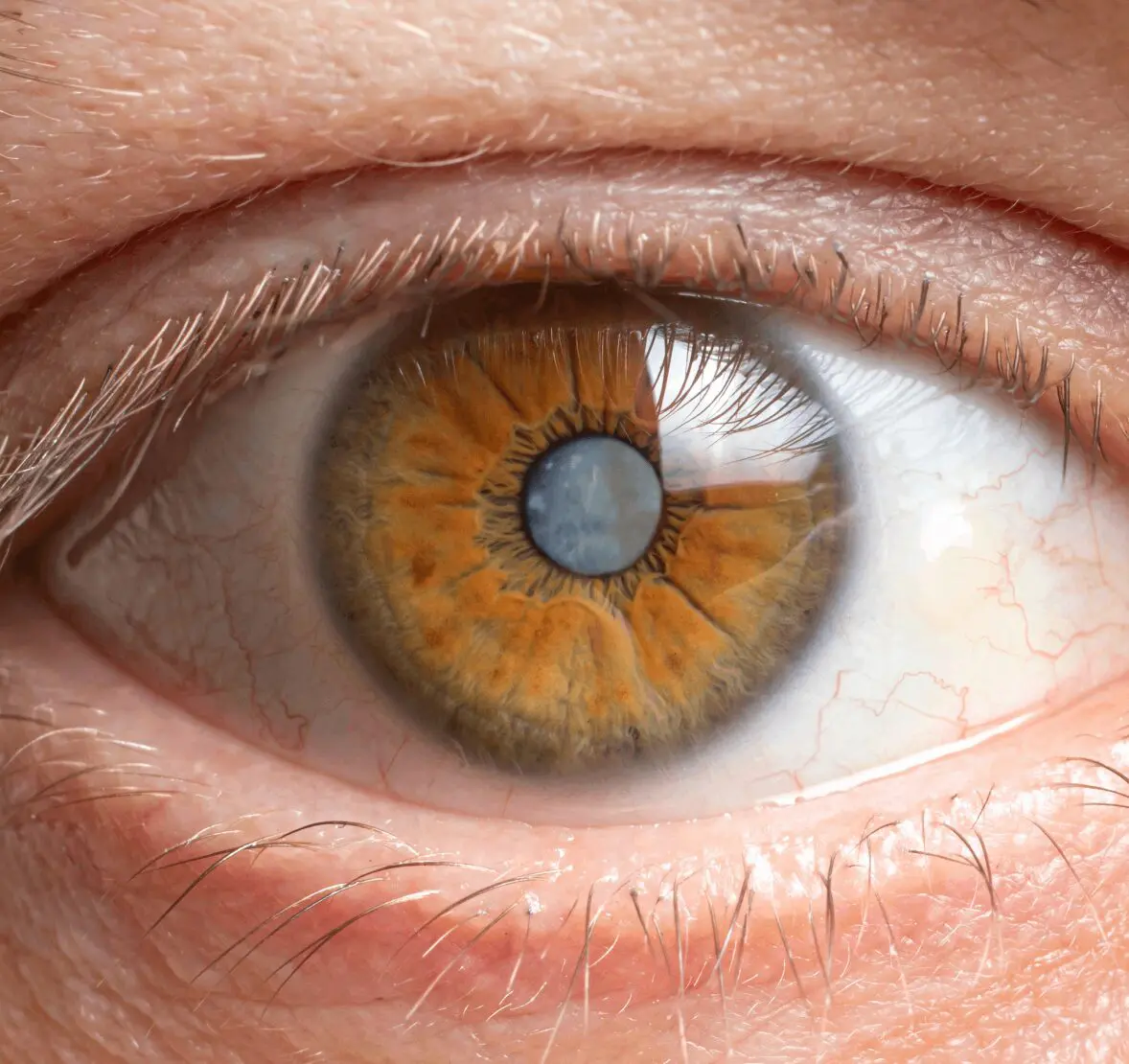 Close-up of a human eye showcasing an amber-colored iris with visible detail and texture.
