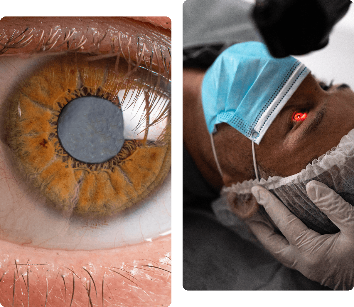 Close-up of an eye with cataract and a person undergoing eye examination with red light near the eye, both images showing medical theme.